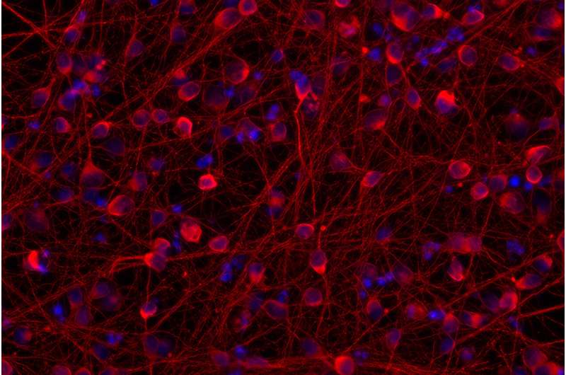MSK researchers hack neurons' internal clocks to accelerate the study of neurological diseases