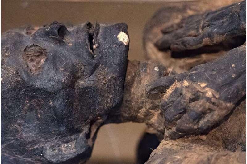 Mummies study finds heart disease plagued the ancients, too