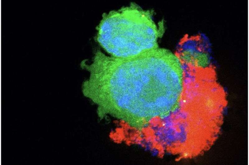 Nano-immunotherapy developed to improve lung cancer treatment