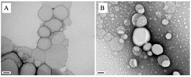 Nanoparticles containing natural substance treat visceral leishmaniasis with scant side effects