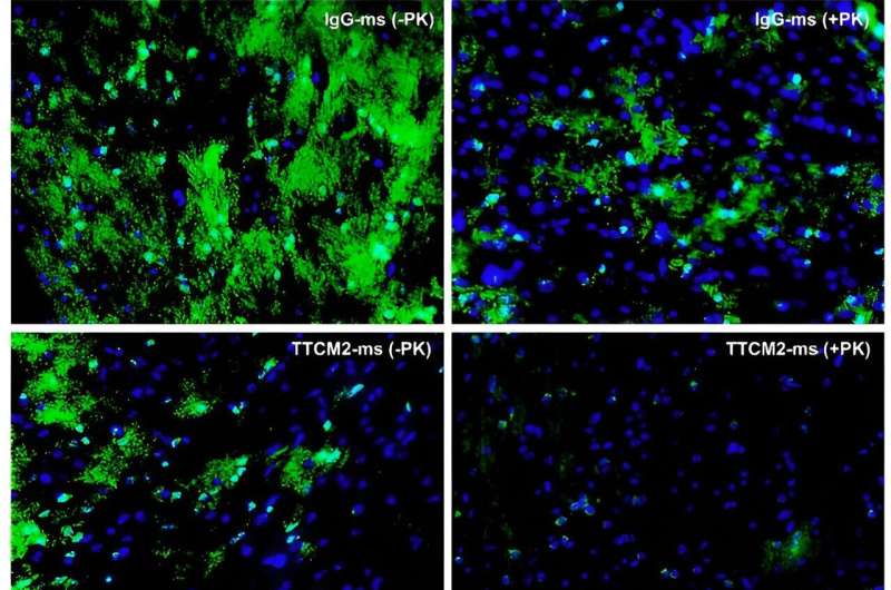 Spray nasale che elimina le proteine ​​tau dai cervelli dei topi affetti da Alzheimer