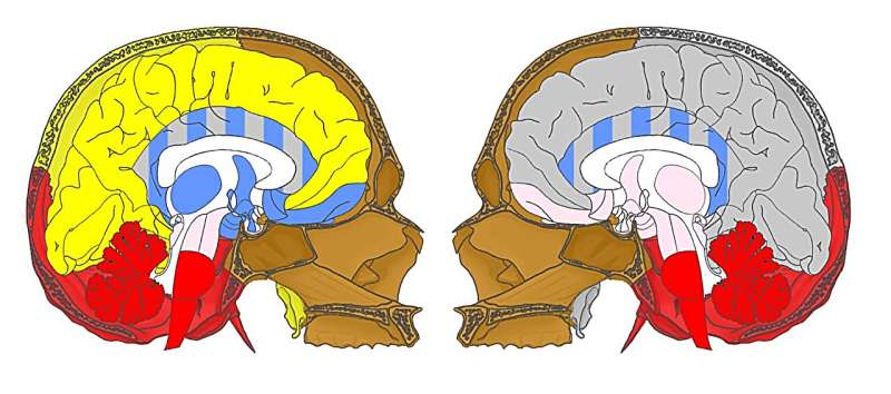 Network models are used to investigate the relationship between skull and brain