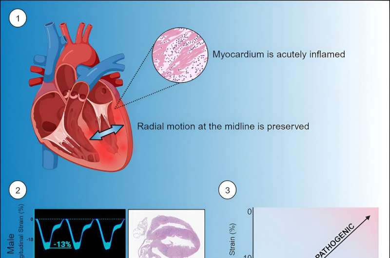 New 4D imaging may detect poor pumping in deadly heart disease