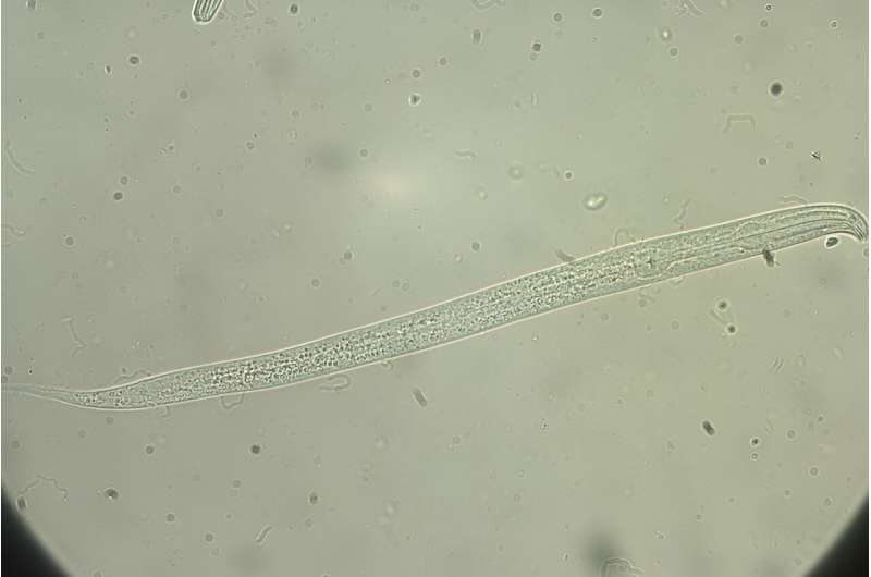 New aging mechanism discovered in nematodes