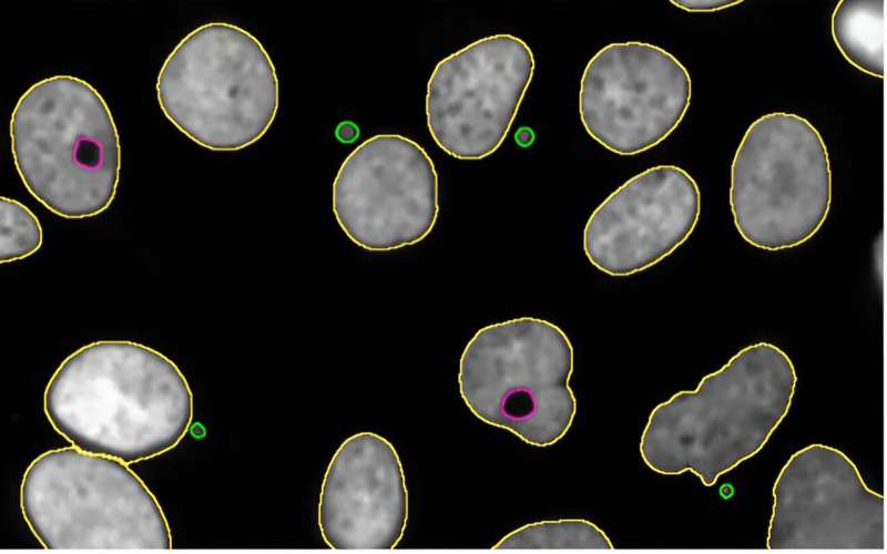 New bioinformatics tool to identify chromosomal alterations in tumor cells 