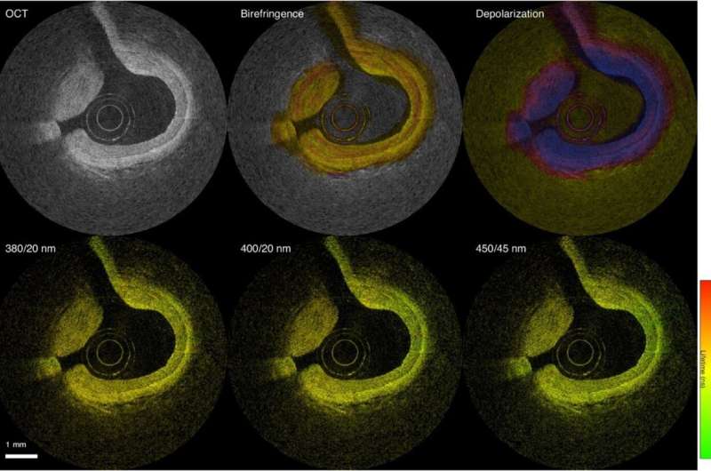 New cardiovascular imaging approach provides a better view of dangerous plaques
