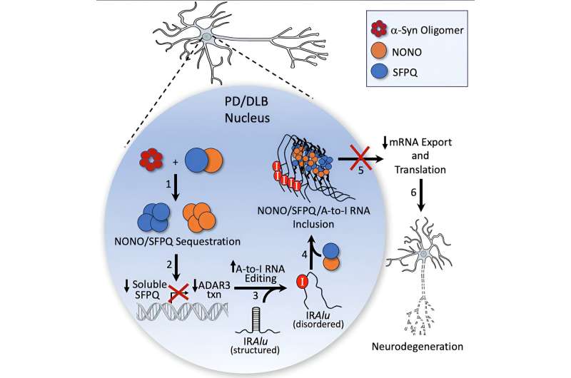 New cellular mechanisms in Parkinson's disease discovered