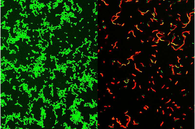 New compound discovered to be efficient towards ‘flesh-eating’ micro organism