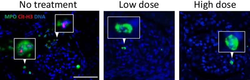 New compound shows great potential for patients with neutrophil-associated inflammation