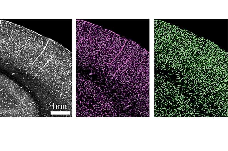 New high-resolution 3D maps show how the brain's blood vessels changes with age