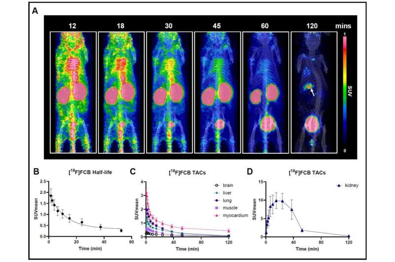 New imaging method detects fungal infections caused by Aspergillus fumigatus faster than before