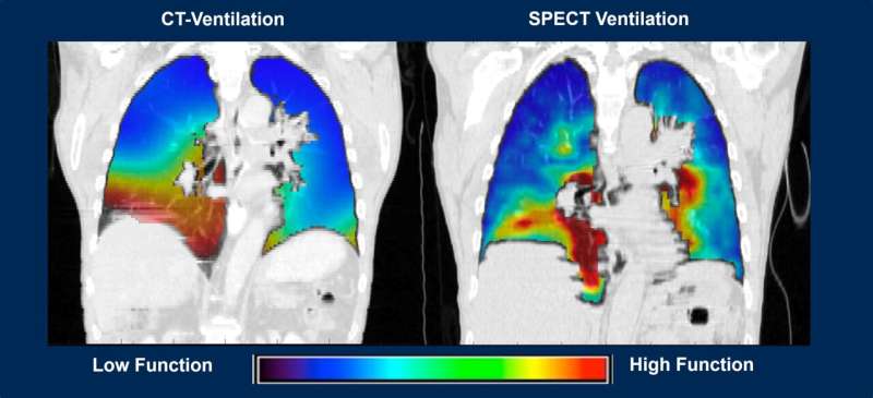 New imaging software improves lung diagnosis for 30% of patients who can't tolerate contrast dye; has added diagnostic benefits for all patients