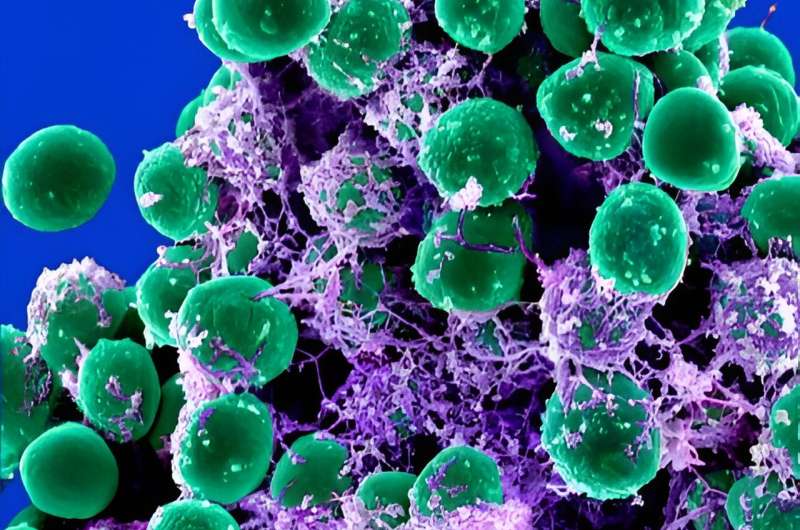 New insights into how epilancin 15X kills bacteria