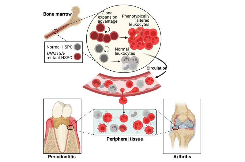 New insights on cellular clones and inflammation in bones
