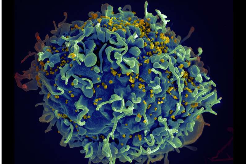 New lab test to detect persistent HIV strains in Africa may aid search for cure