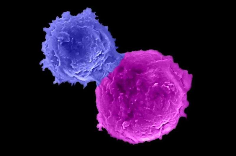 New method to engineer immune cells that could treat multiple cancer patients
