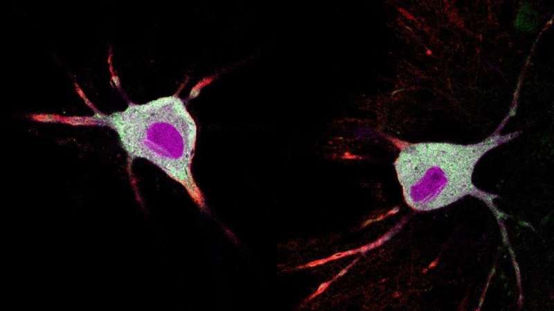 New method tracks how psychedelics affect neurons in minutes