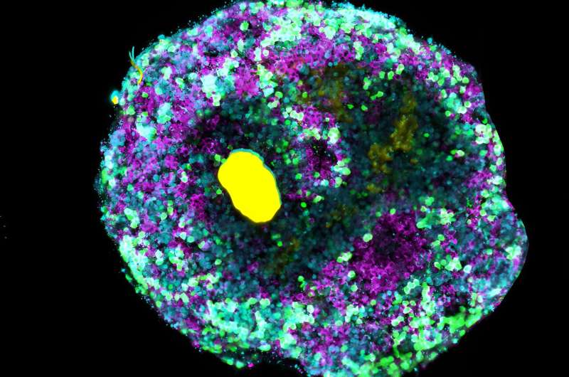 New molecular engineering technique allows for complex organoids