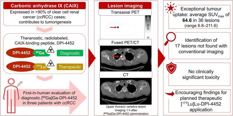 Novo agente PET fornece imagens excepcionais no mesmo dia para pacientes com carcinoma de células renais de células claras