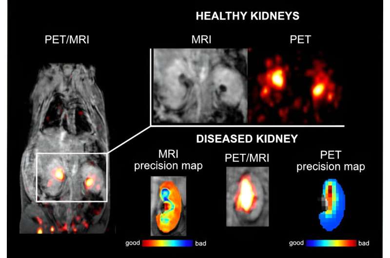 New PET/MRI probe developed by IOCB Prague promises early discovery of covert diseases