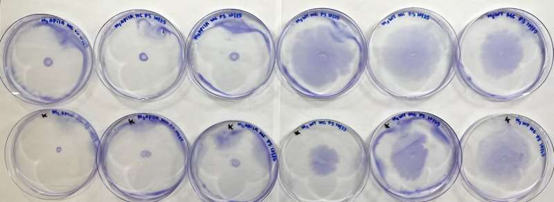 New research illuminates the impact of surface properties on bacteria movement