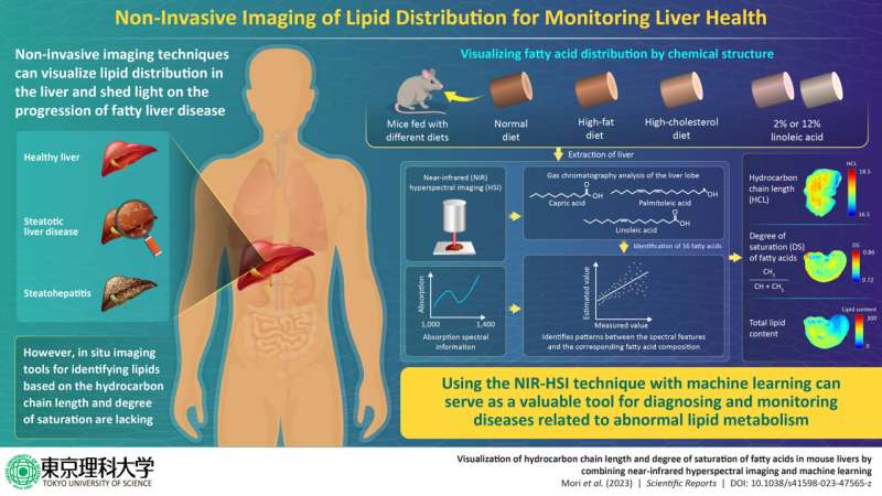 New study unveils machine learning-aided non-invasive imaging for rapid liver fat visualization
