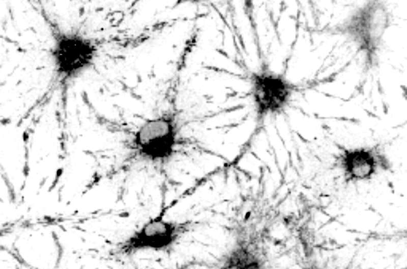 New tool provides researchers with improved understanding of stem cell aging in the brain