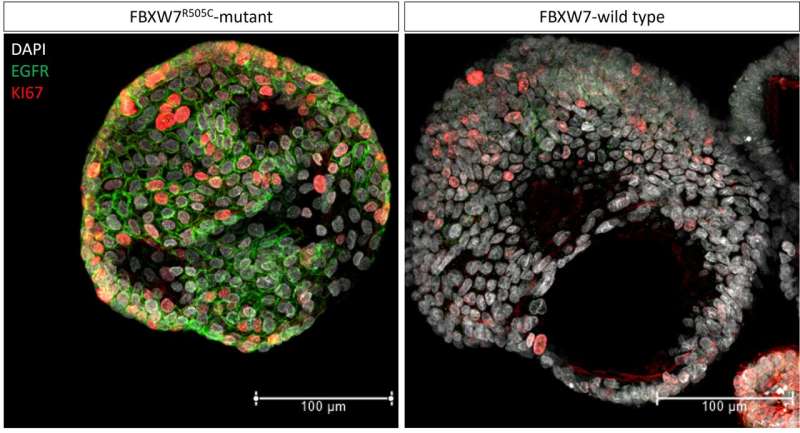 Newly discovered link between FBXW7 mutations and EGFR signaling in colorectal cancer