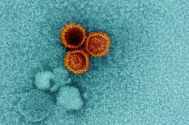 NIH scientists find weak points on Epstein-Barr virus