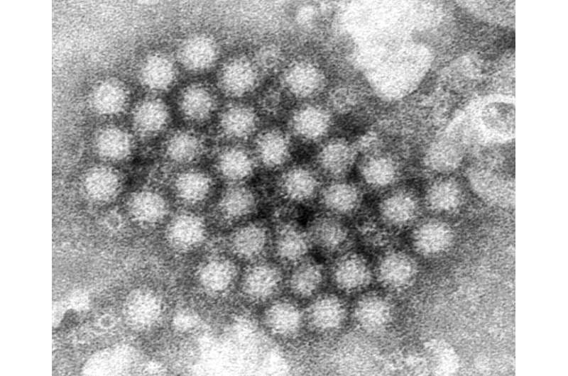 Norovirus illnesses are up in some places. Here's what you need to know