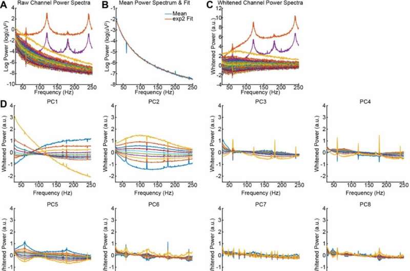 Novel algorithm improves intracranial EEG accuracy to improve future patient care