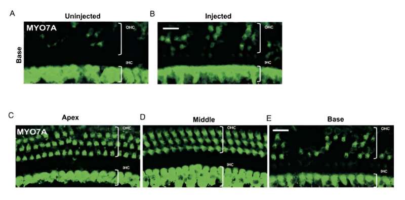 Novel genome editing approach restores hearing in adult preclinical models with genetic deafness