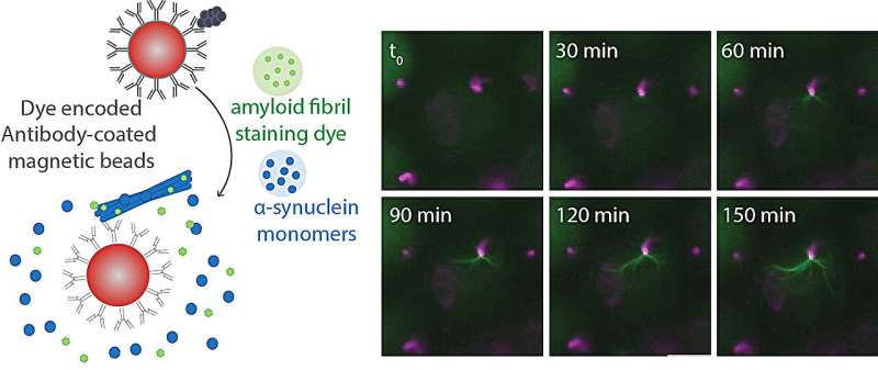 Novel test holds promise for detecting Parkinson's disease early