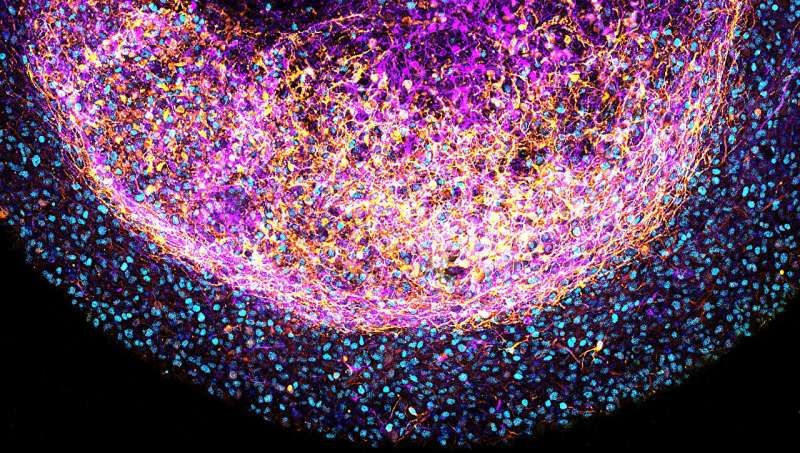Novel tissue-derived brain organoids could revolutionize brain research