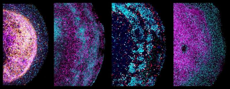 Novel tissue-derived brain organoids could revolutionize brain research
