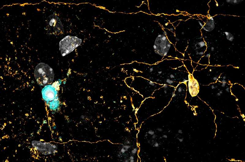 Older brain cells linger unexpectedly before their death