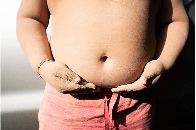 One in five children globally has excess weight
