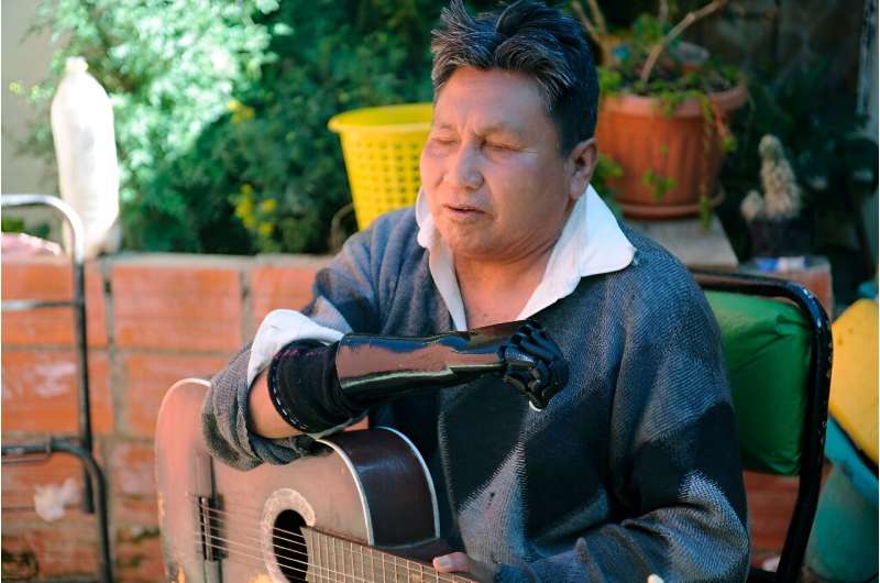 Pablo Matha, 59, who lost part of his right arm and his sight due to mishandling dynamite in a mining accident, can now play guitar