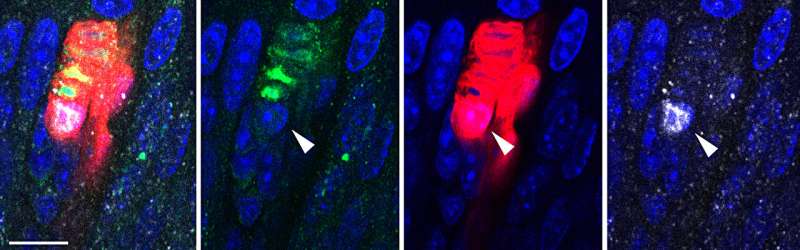 Pain and touch sensations require Schwann cells