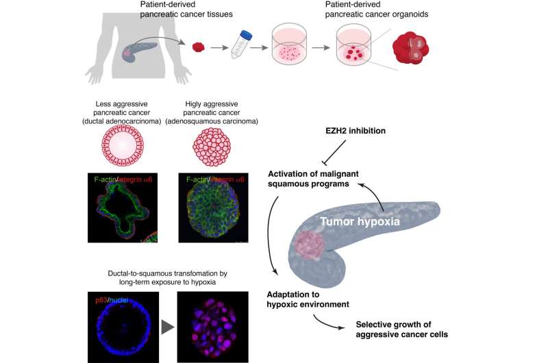 Pancreatic cancers change identity as they transform into aggressive types ― an organoid study