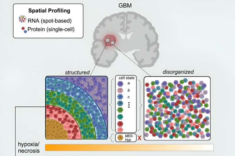 Peeling back the layers of brain tumors