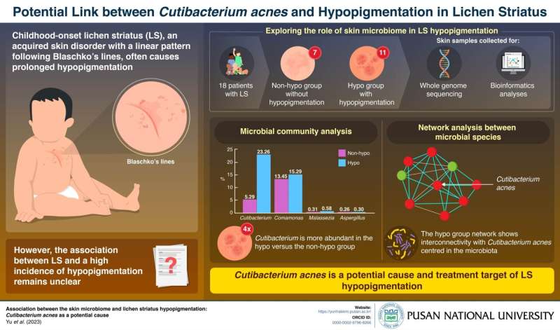 PNU researchers reveal cutibacterium acnes as a potential cause of lichen striatus hypopigmentation
