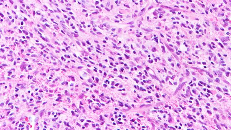 Potential new drug to target rare childhood brain tumour