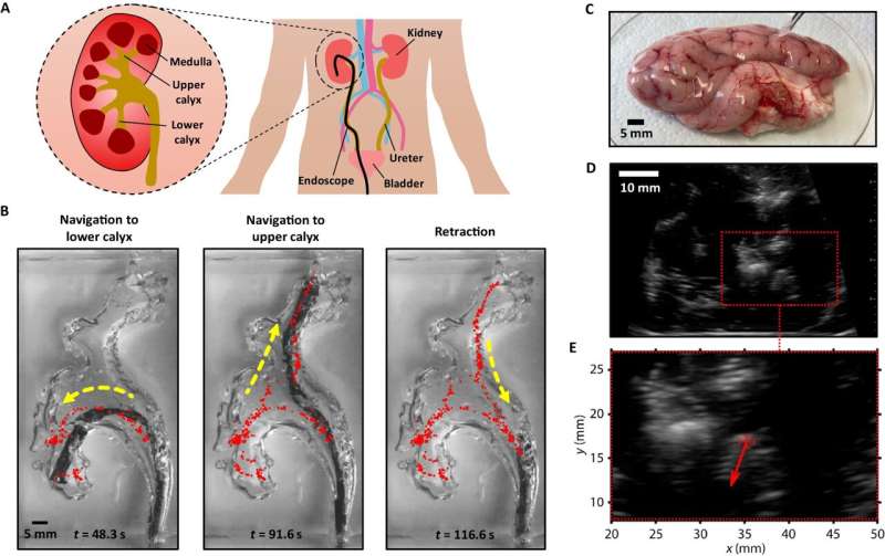 Precise localization of miniature robots and surgical instruments inside the body