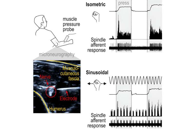 Pressure sensing by muscles is a promising new target for treatments