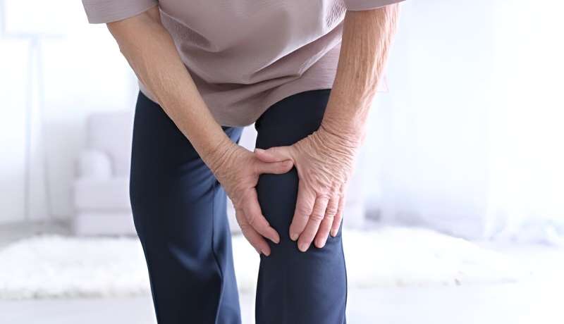 Prevalence of arthritis in U.S. adults 18.9 percent in 2022