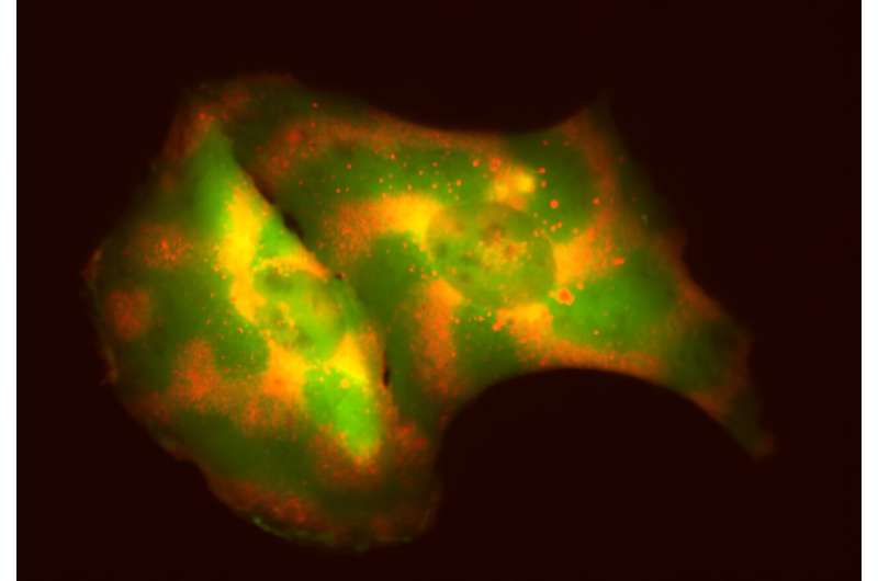 Programming cells to organize their molecules may open the door to new treatments