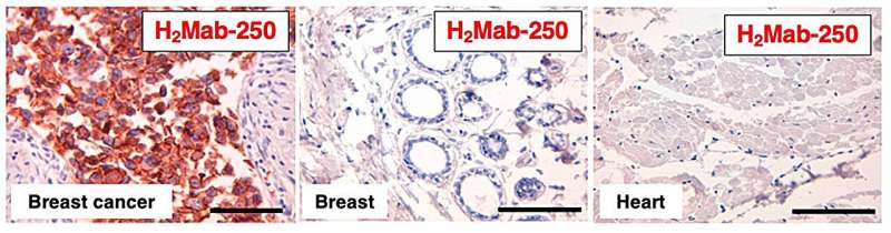 Promising development for breast cancer patients