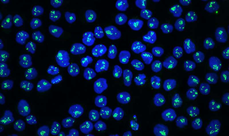 Protein discovery sparks treatment hope for aggressive cancer