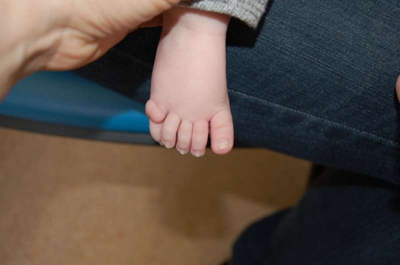 Rare disorder causing extra fingers and toes identified
